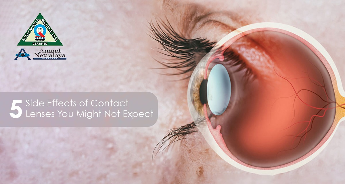 Side Effects of Contact Lenses.php